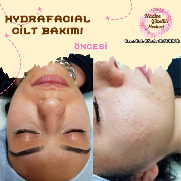 Nadire Güzellik Salonu - 65. Fotoğraf Nadire Güzellik Salonu - 65. Fotoğraf