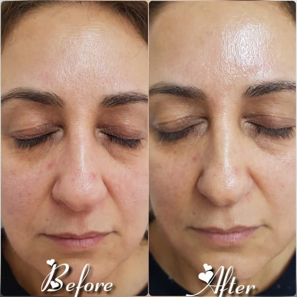 Nadire Güzellik Salonu - 35. Fotoğraf Nadire Güzellik Salonu - 35. Fotoğraf