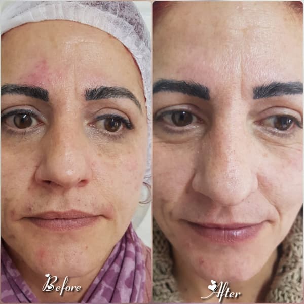 Nadire Güzellik Salonu - 29. Fotoğraf