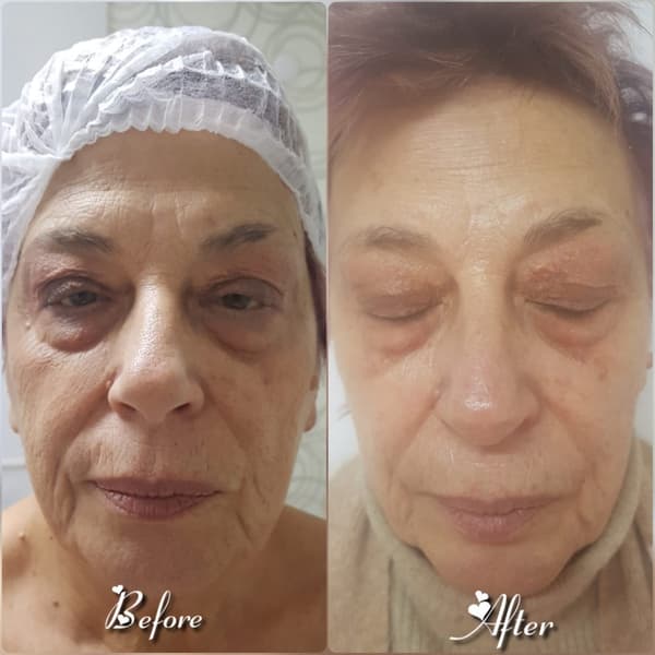 Nadire Güzellik Salonu - 24. Fotoğraf Nadire Güzellik Salonu - 24. Fotoğraf