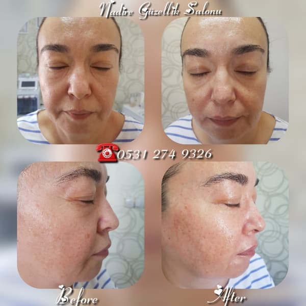 Nadire Güzellik Salonu - 20. Fotoğraf Nadire Güzellik Salonu - 20. Fotoğraf