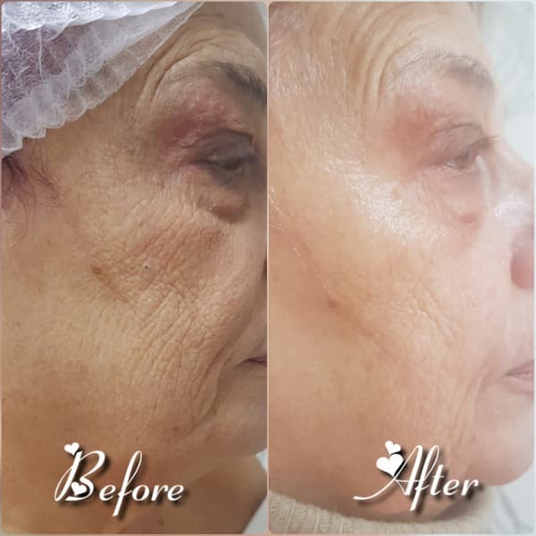 Nadire Güzellik Salonu - 25. Fotoğraf Nadire Güzellik Salonu - 25. Fotoğraf