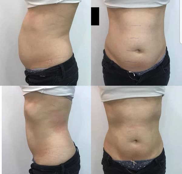 Nadire Güzellik Salonu - 53. Fotoğraf Nadire Güzellik Salonu - 53. Fotoğraf