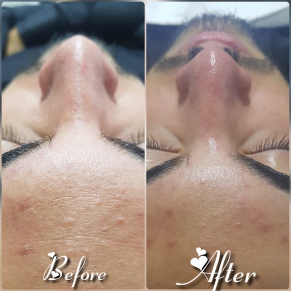 Nadire Güzellik Salonu - 40. Fotoğraf Nadire Güzellik Salonu - 40. Fotoğraf