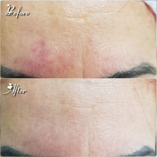 Nadire Güzellik Salonu - 33. Fotoğraf Nadire Güzellik Salonu - 33. Fotoğraf