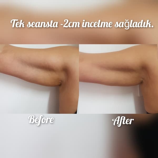 Nadire Güzellik Salonu - 13. Fotoğraf Nadire Güzellik Salonu - 13. Fotoğraf