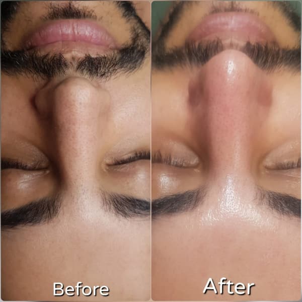 Nadire Güzellik Salonu - 59. Fotoğraf Nadire Güzellik Salonu - 59. Fotoğraf