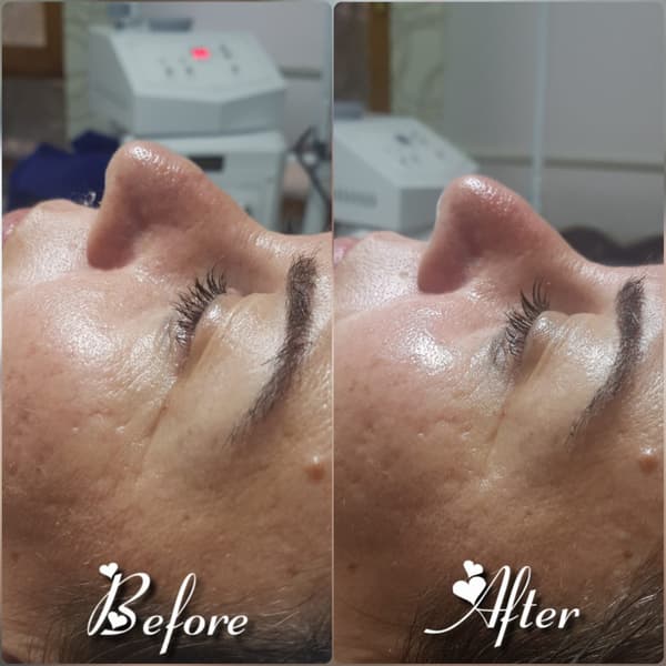 Nadire Güzellik Salonu - 37. Fotoğraf Nadire Güzellik Salonu - 37. Fotoğraf