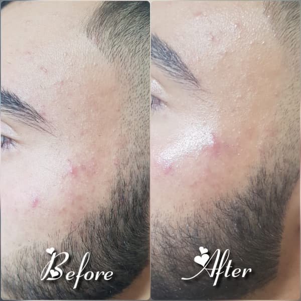 Nadire Güzellik Salonu - 44. Fotoğraf Nadire Güzellik Salonu - 44. Fotoğraf