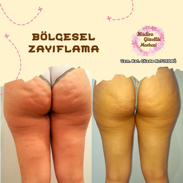 Nadire Güzellik Salonu - 66. Fotoğraf Nadire Güzellik Salonu - 66. Fotoğraf