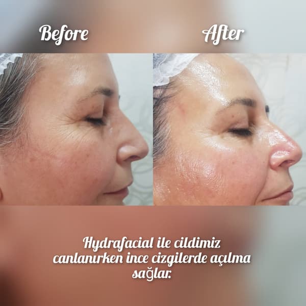 Nadire Güzellik Salonu - 22. Fotoğraf Nadire Güzellik Salonu - 22. Fotoğraf