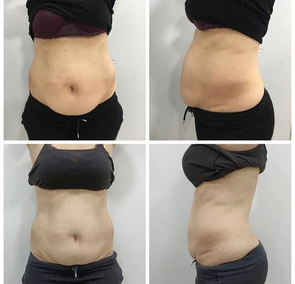 Nadire Güzellik Salonu - 54. Fotoğraf Nadire Güzellik Salonu - 54. Fotoğraf