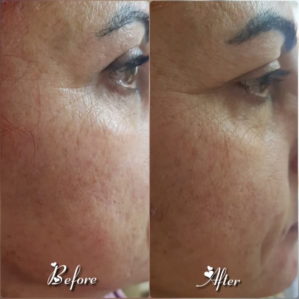 Nadire Güzellik Salonu - 31. Fotoğraf Nadire Güzellik Salonu - 31. Fotoğraf