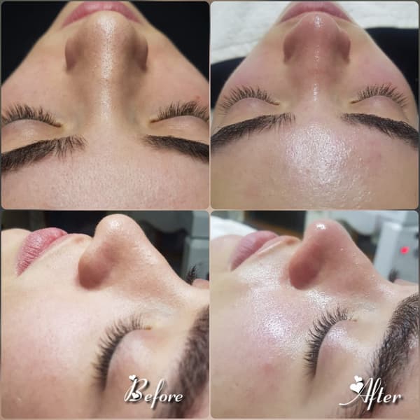 Nadire Güzellik Salonu - 30. Fotoğraf Nadire Güzellik Salonu - 30. Fotoğraf