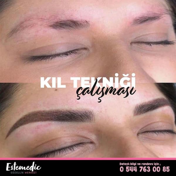 Estemedic Güzellik Merkezi - 7. Fotoğraf Estemedic Güzellik Merkezi - 7. Fotoğraf