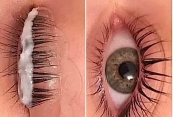 Estemedic Güzellik Merkezi - 6. Fotoğraf Estemedic Güzellik Merkezi - 6. Fotoğraf