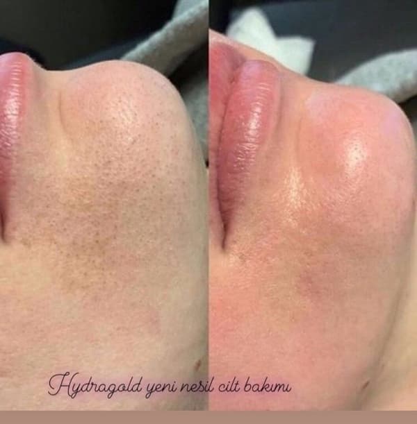 Estemedic Güzellik Merkezi - 1. Fotoğraf Estemedic Güzellik Merkezi - 1. Fotoğraf