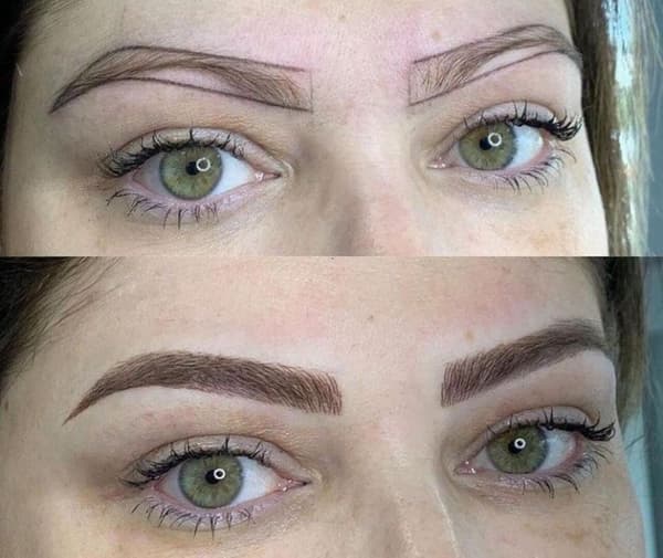 Estemedic Güzellik Merkezi - 4. Fotoğraf Estemedic Güzellik Merkezi - 4. Fotoğraf