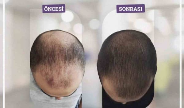 Touch Güzellik Salonu - 6. Fotoğraf