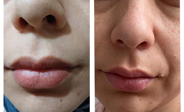 Touch Güzellik Salonu - 10. Fotoğraf