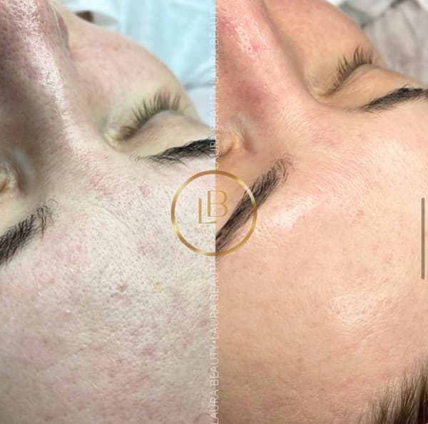Laura Beauty  - 7. Fotoğraf