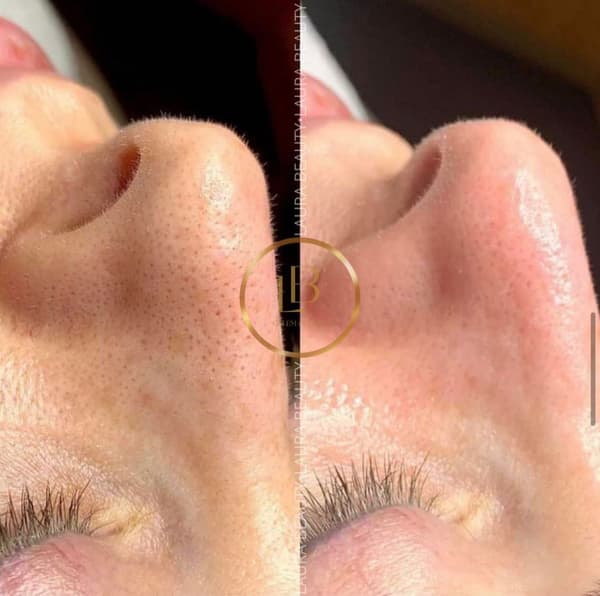 Laura Beauty  - 1. Fotoğraf