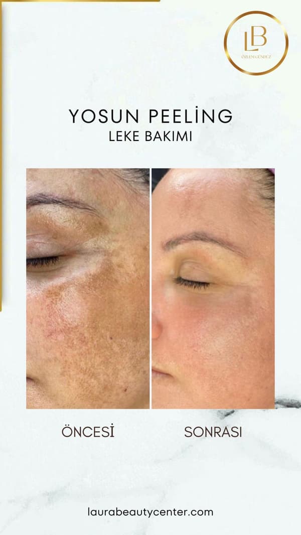 Laura Beauty  - 3. Fotoğraf
