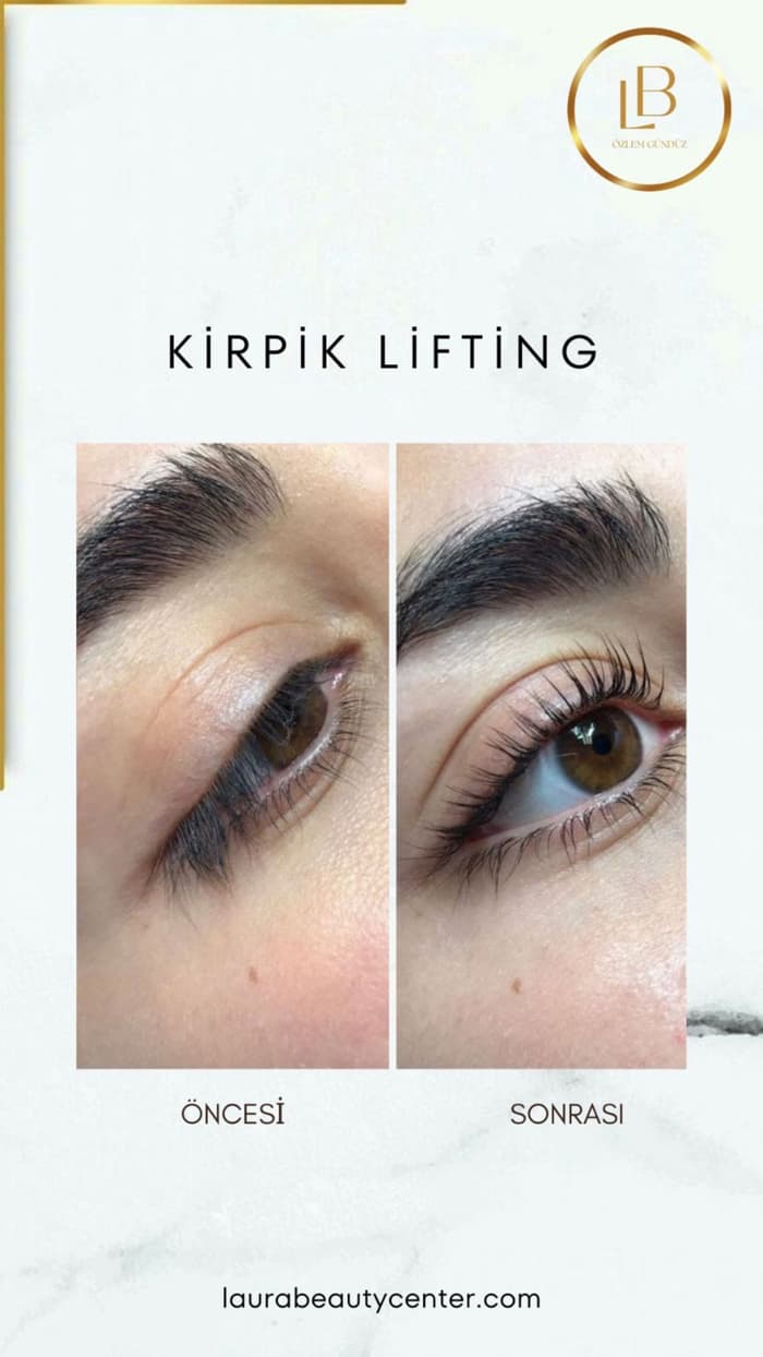 Laura Beauty  - 5. Fotoğraf