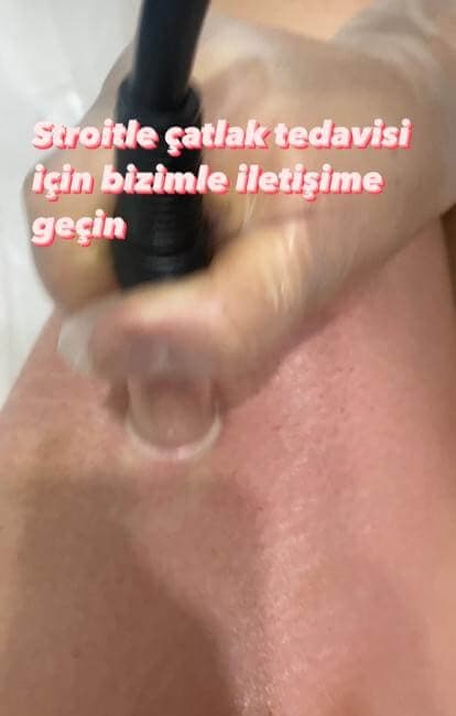 Şule Gürsoy Güzellik Salonu  - 20. Fotoğraf Şule Gürsoy Güzellik Salonu  - 20. Fotoğraf