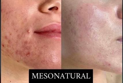 Şule Gürsoy Güzellik Salonu  - 32. Fotoğraf Şule Gürsoy Güzellik Salonu  - 32. Fotoğraf