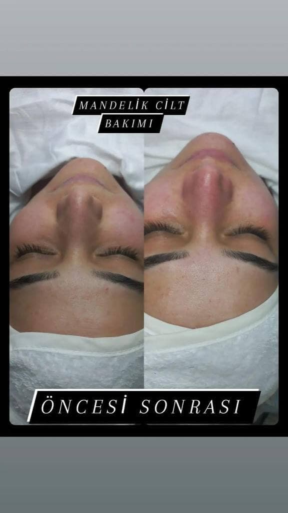 Şule Gürsoy Güzellik Salonu  - 26. Fotoğraf Şule Gürsoy Güzellik Salonu  - 26. Fotoğraf