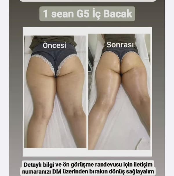 Songül Şahin Güzellik Salonu - 21. Fotoğraf