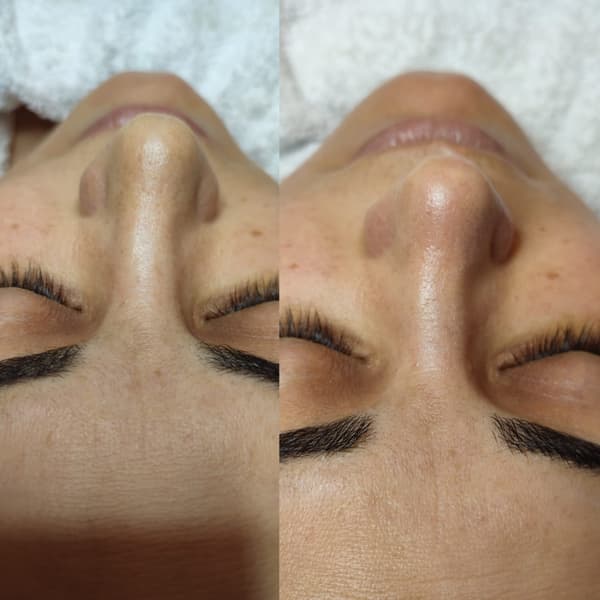 Songül Şahin Güzellik Salonu - 13. Fotoğraf Songül Şahin Güzellik Salonu - 13. Fotoğraf