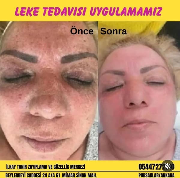 İlkay Tanır Güzellik Salonu - 3. Fotoğraf İlkay Tanır Güzellik Salonu - 3. Fotoğraf