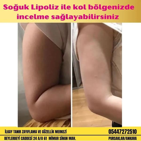İlkay Tanır Güzellik Salonu - 2. Fotoğraf İlkay Tanır Güzellik Salonu - 2. Fotoğraf