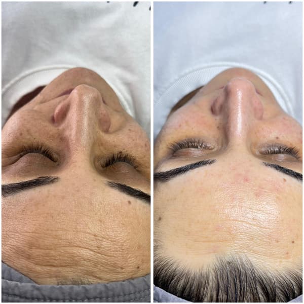 Gülay Koç Güzellik - 7. Fotoğraf Gülay Koç Güzellik - 7. Fotoğraf