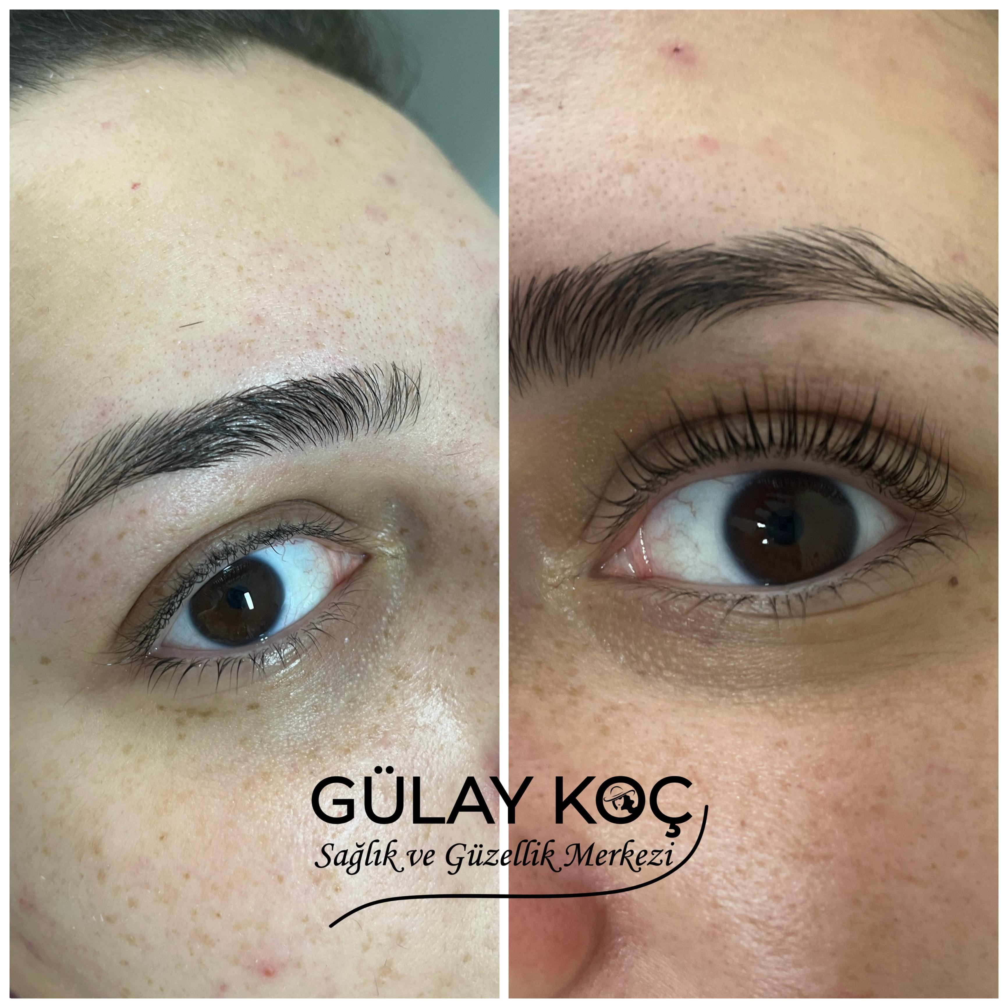 Gülay Koç Güzellik