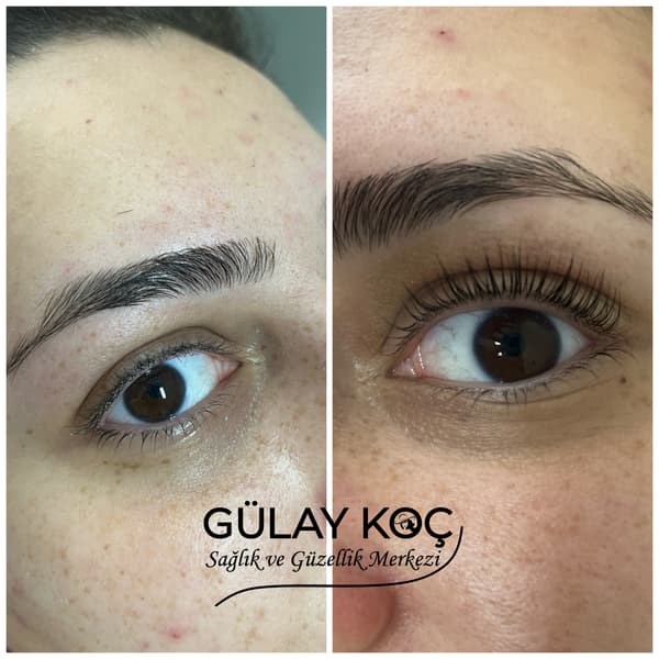 Gülay Koç Güzellik - 6. Fotoğraf Gülay Koç Güzellik - 6. Fotoğraf