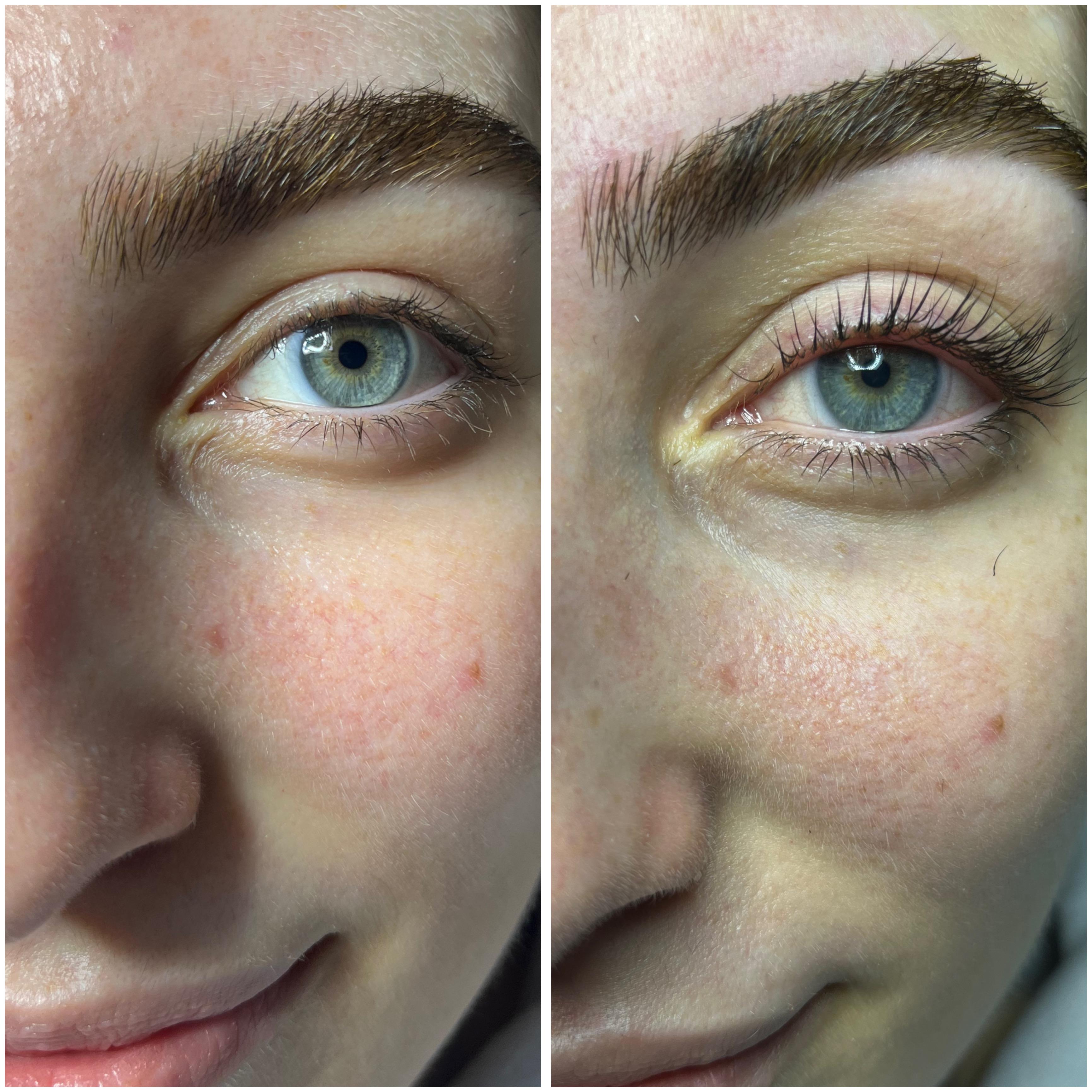 Gülay Koç Güzellik - 2. Fotoğraf