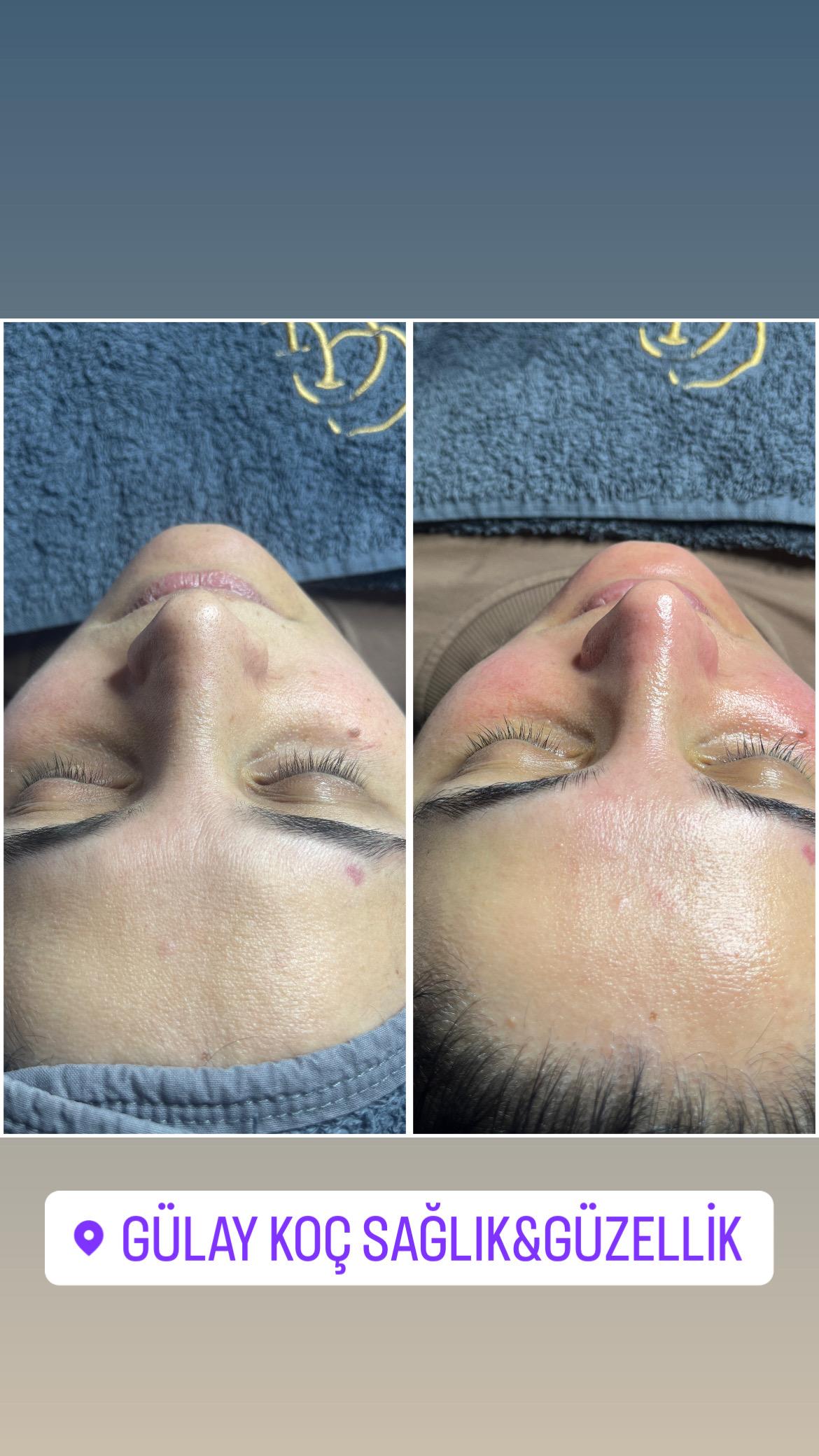 Gülay Koç Güzellik
