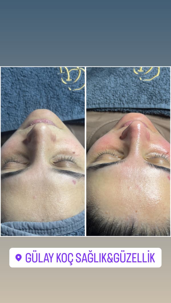 Gülay Koç Güzellik - 10. Fotoğraf Gülay Koç Güzellik - 10. Fotoğraf