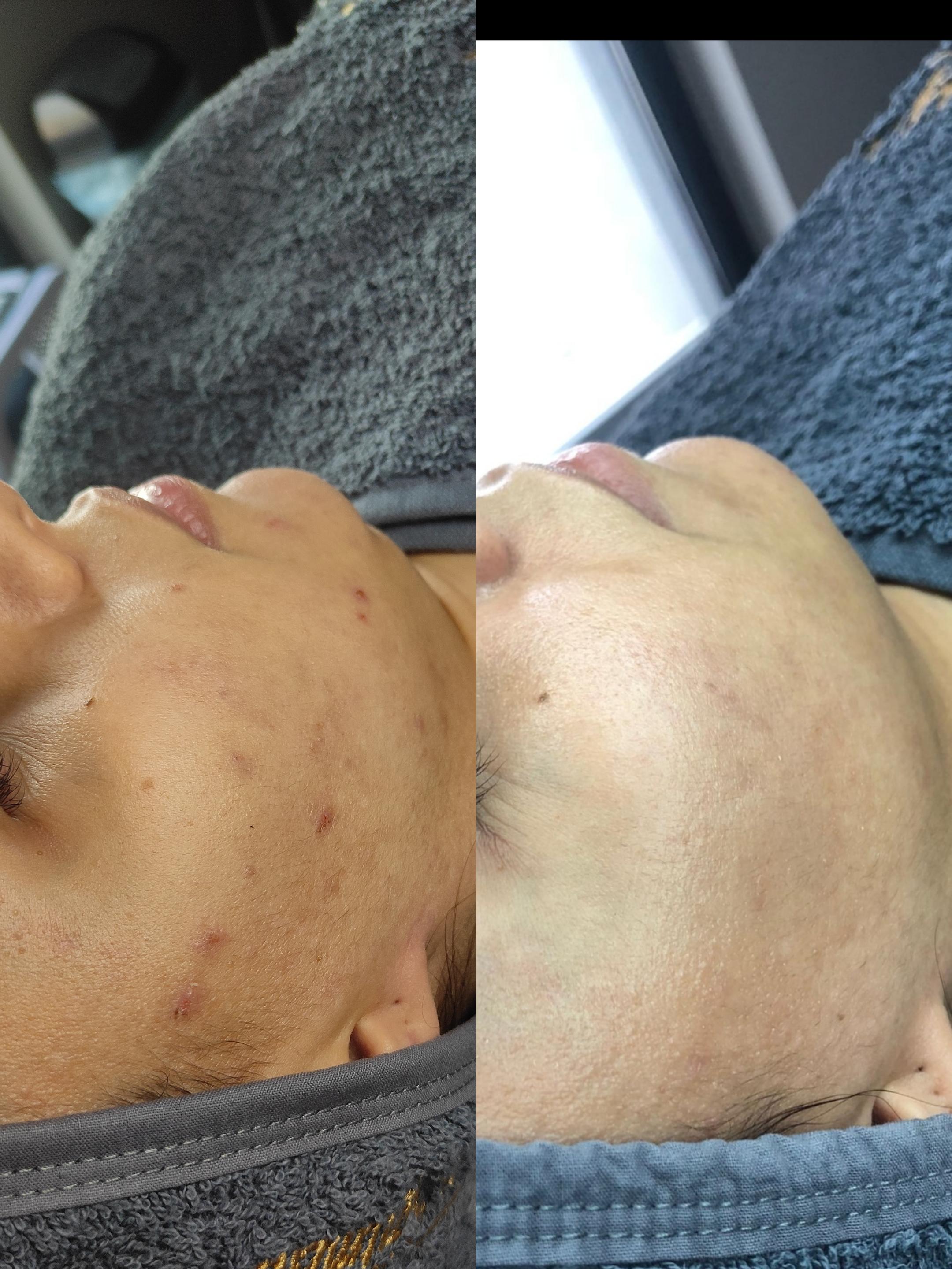 Gülay Koç Güzellik