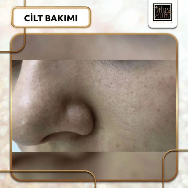 İlus Güzellik Salonu - 15. Fotoğraf
