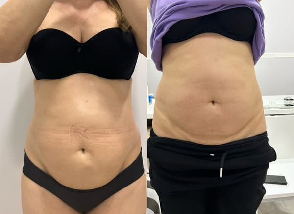 Serra Güzellik - 6. Fotoğraf Serra Güzellik - 6. Fotoğraf