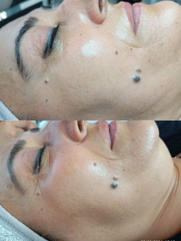 Plus Güzellik Merkezi - 4. Fotoğraf