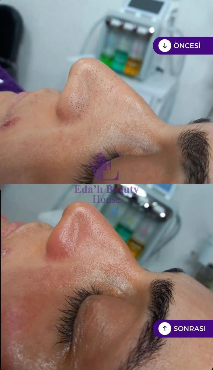Edalı Beauty House - 2. Fotoğraf