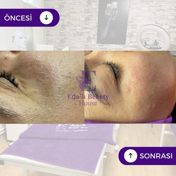 Edalı Beauty House - 10. Fotoğraf