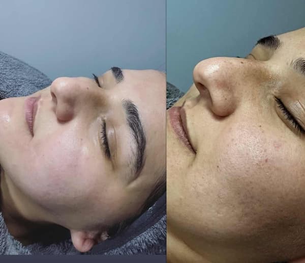 Tuğba Beauty Therapy - 10. Fotoğraf