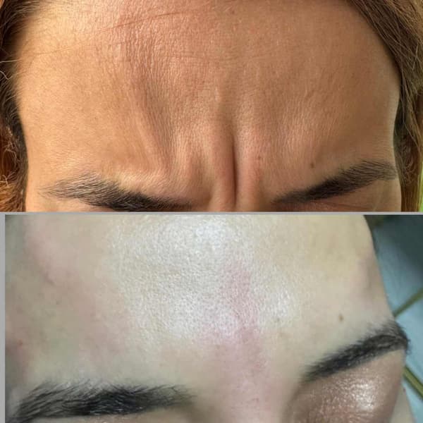 Tuğba Beauty Therapy - 18. Fotoğraf Tuğba Beauty Therapy - 18. Fotoğraf