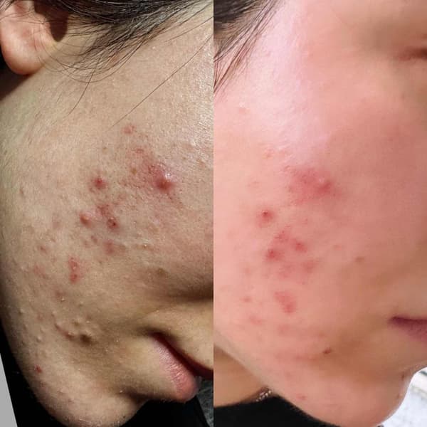 Tuğba Beauty Therapy - 20. Fotoğraf